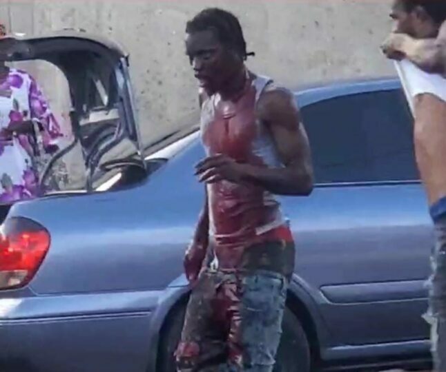 Man who allegedly shot another near his face remanded