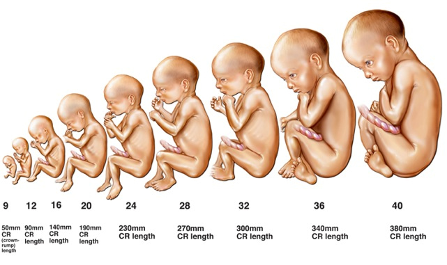 Caribbean groups urge Antigua and Barbuda, and Dominica to defend their pro-life laws