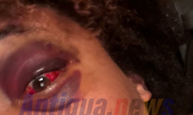 EXCLUSIVELY ON ANTIGUA NEWS: Young Woman Beaten by Assistant Pastor