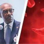 Minister of Health Sir Molwyn Joseph announces sickle cell healthcare initiative