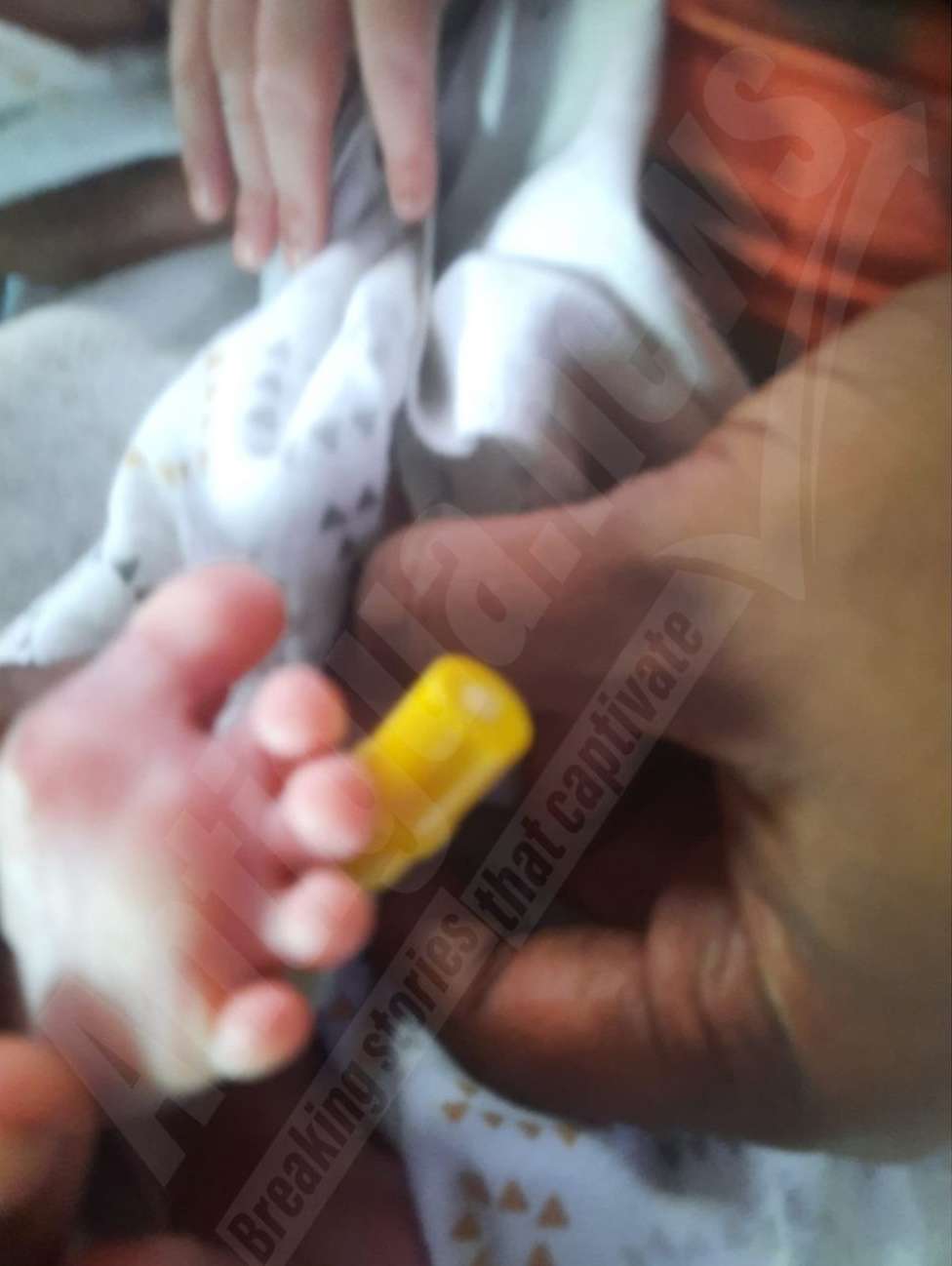 Parents Seek Legal Advice After Needle Discovered in Newborn's Foot Post-Discharge