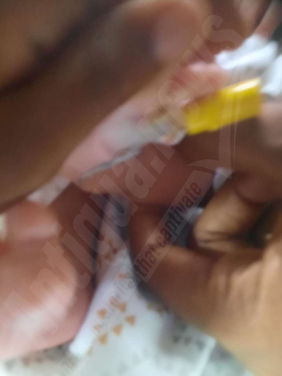 Parents Seek Legal Advice After Needle Discovered in Newborn's Foot Post-Discharge