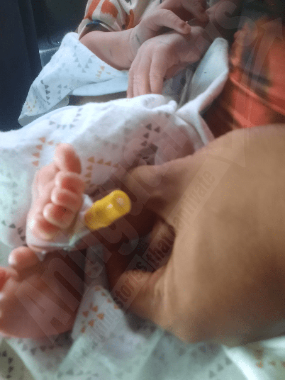 Parents Seek Legal Advice After Needle Discovered in Newborn's Foot Post-Discharge