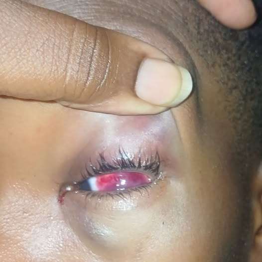 Mother Leaves SLBMC With Injured Son After Being Told Doctor Wouldn’t See Patients