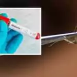 Two Cases of Malaria Confirmed in Antigua and Barbuda as Government Strengthens Health Surveillance